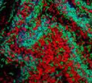 Bacterial Biofilm 5