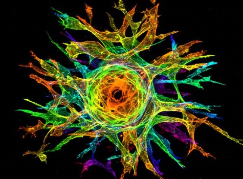 Sprouting Endothelial Cells_Karina Kinghorn_UNC