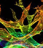 Sprouting-Endothelial-Cells_Karina-Kinghorn_UNC_1