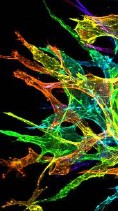Sprouting-Endothelial-Cells_Karina-Kinghorn_UNC_2