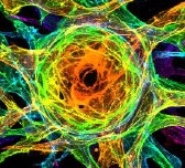 Sprouting-Endothelial-Cells_Karina-Kinghorn_UNC_3